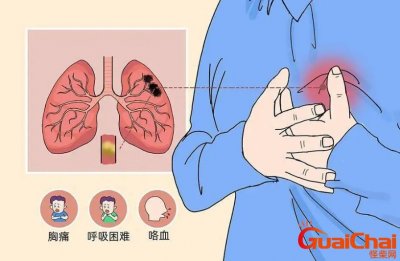 ​肺栓塞是怎么引起的？肺栓塞有哪些症状？