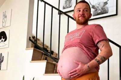 ​美国男人自然怀孕生了个男孩，连体人也能结婚生子，怎么回事？