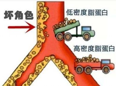 ​高血脂,高胆固醇怎样降下来